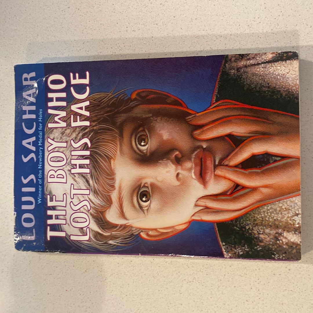 The boy who lost his face