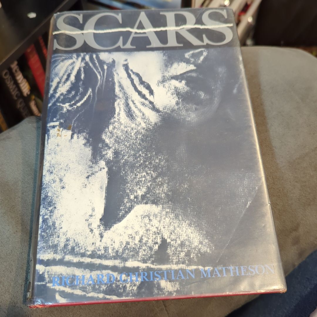 Scars
