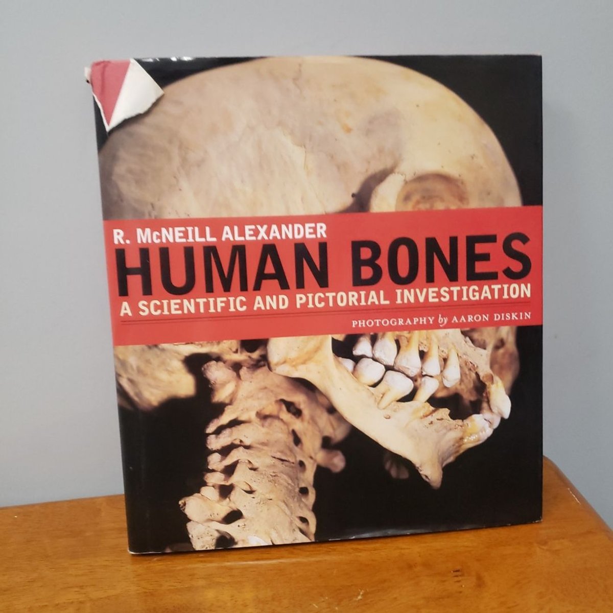 Human Bones by R. McNeill Alexander, Aaron Diskin