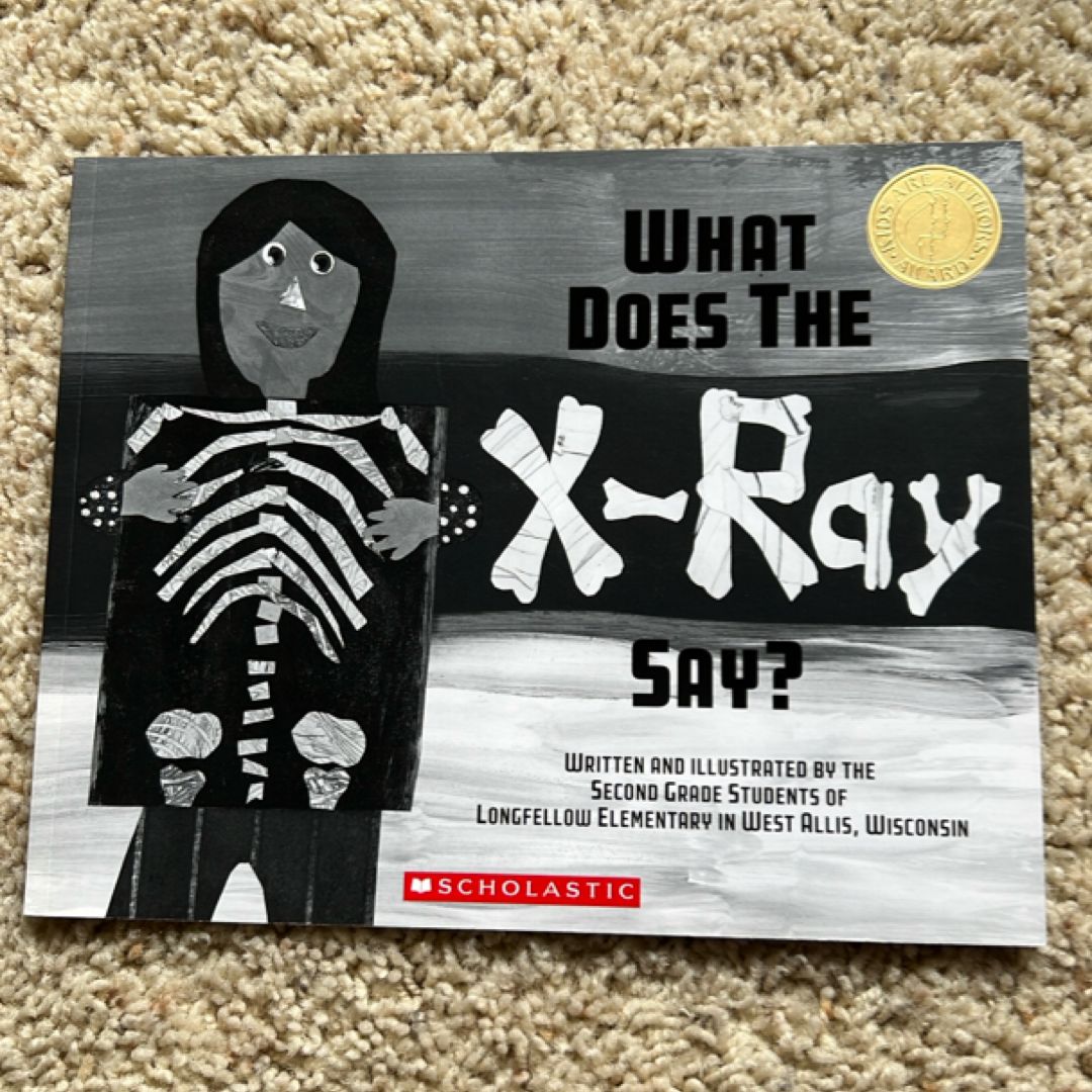 What Does the X-ray Say?