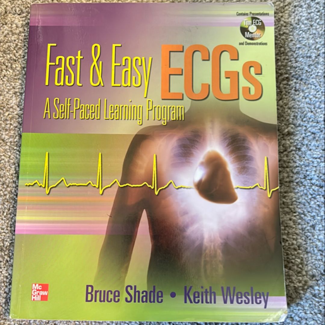 Fast and Easy ECGs