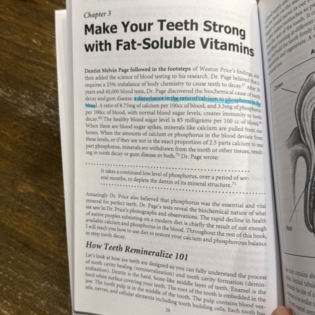 Cure Tooth Decay: Heal and Prevent Cavities with Nutrition